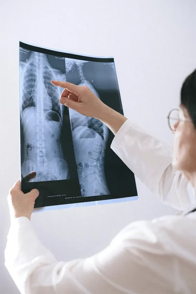 Scoliosis Conditions Treatment Chiropractor Belmar, NJ